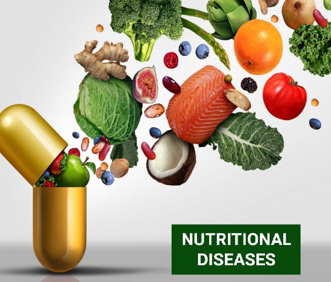 Nutritional Diseases